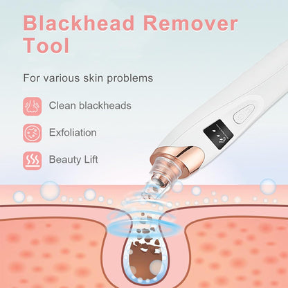 Pore Vacuum