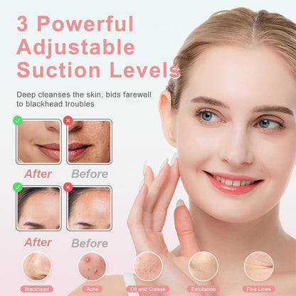 Pore Vacuum